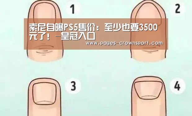 皇冠入口